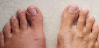 One month before a heart attack, your body will warn you of these 7 signs, especially to the 6th