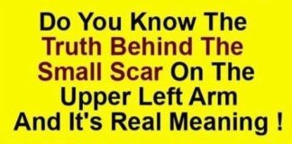 Smallpox Vaccine Scars: What They Are and Why They Form