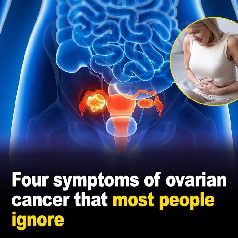 4 Early Symptoms Of Ovarian Cancer That Every Woman Needs To Know ...
