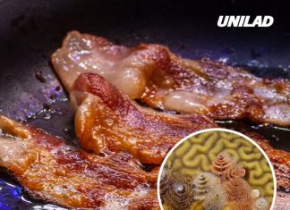 Man develops ‘pork worms’ in his brain after years of doing this specific cooking habit