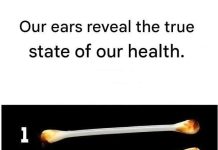 Our ears reveal the true state of our health