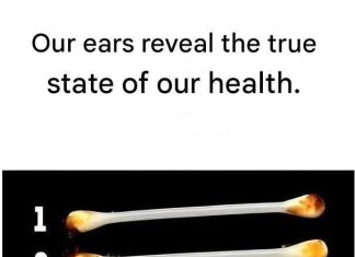 Our ears reveal the true state of our health