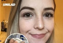 Woman, 23, issues warning after neck-cracking habit ruptured major artery and left her paralyzed