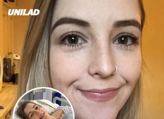 Woman, 23, issues warning after neck-cracking habit ruptured major artery and left her paralyzed