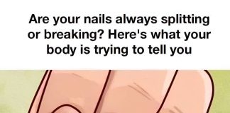 Doctor Reveals 7 Health Conditions You Can Spot By Just Checking Your Nails