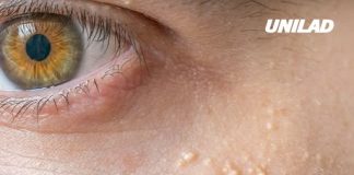 Reason behind series of white spots on your body and private parts as experts issue serious warning