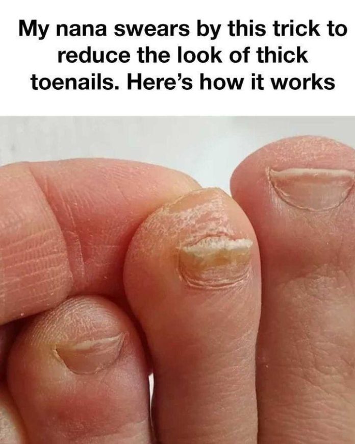 toe