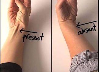 If a Tendon Raises Up When You Touch Your Pinky to Your Thumb, Here’s What It Could Mean