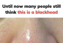 THOSE TINY DOTS ON YOUR NOSE AREN’T BLACKHEADS — HERE’S WHAT SEBACEOUS FILAMENTS REALLY ARE