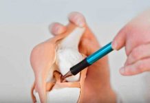 5 FOODS THAT SECRETLY STEAL CALCIUM AND WEAKEN YOUR BONES