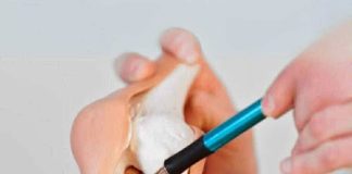 5 FOODS THAT SECRETLY STEAL CALCIUM AND WEAKEN YOUR BONES