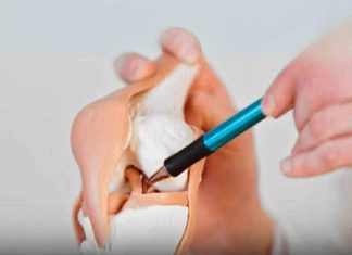 5 FOODS THAT SECRETLY STEAL CALCIUM AND WEAKEN YOUR BONES