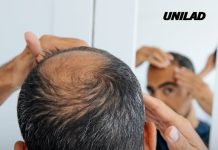 Scientists discover breakthrough ‘cure’ for hair loss which takes just 20 days