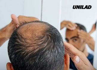 Scientists discover breakthrough ‘cure’ for hair loss which takes just 20 days