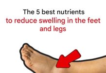 The 5 best nutrients to reduce swelling in the feet and legs