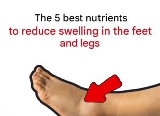The 5 best nutrients to reduce swelling in the feet and legs