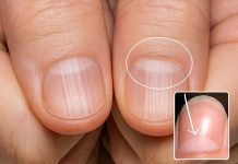 What Does The Half Moon at The Base of The Nails Mean