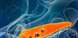 6 WARNING SIGNS OF PANCREATIC CANCER YOU SHOULDN’T OVERLOOK