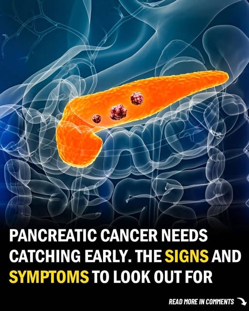 pancreas