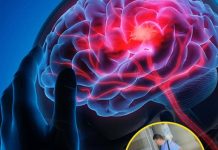 Stroke Prevention Tips: 3 Things to Avoid After Eating and 4 Before Bedtime