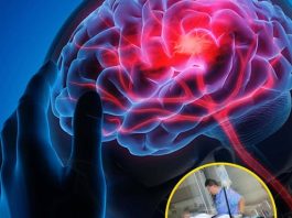 Stroke Prevention Tips: 3 Things to Avoid After Eating and 4 Before Bedtime