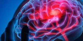 Stroke Prevention Tips: 3 Things to Avoid After Eating and 4 Before Bedtime