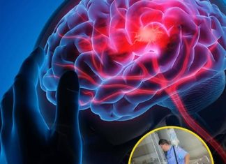 Stroke Prevention Tips: 3 Things to Avoid After Eating and 4 Before Bedtime