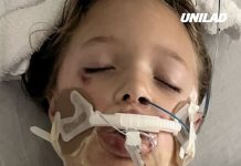 Girl, 7, left in coma with horrific injuries after toy exploded in her face when attempting trend she’d seen online