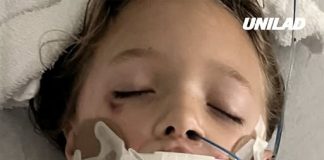 Girl, 7, left in coma with horrific injuries after toy exploded in her face when attempting trend she’d seen online