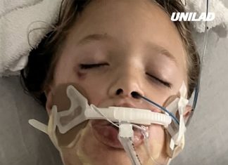 Girl, 7, left in coma with horrific injuries after toy exploded in her face when attempting trend she’d seen online