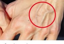 If you have visible veins, it means you are…