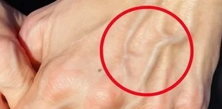 If you have visible veins, it means you are…