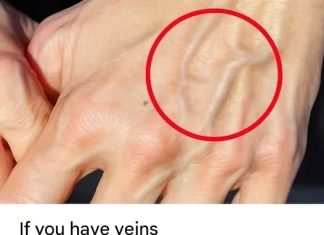 If you have visible veins, it means you are…