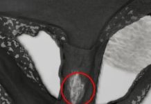 NOTICED A BLEACH-LIKE STAIN ON YOUR UNDERWEAR? HERE’S WHAT IT REALLY MEANS FOR YOUR HEALTH