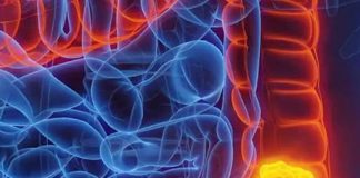 Woman reveals five colon cancer symptoms that should not be ignored