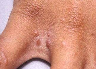 11 Reasons Why You Have Red Dots On Your Skin