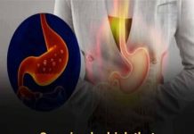 INSTANT RELIEF: THIS SIMPLE, NATURAL DRINK HELPS REDUCE GASTROESOPHAGEAL REFLUX AND HEARTBURN EFFECTIVELY