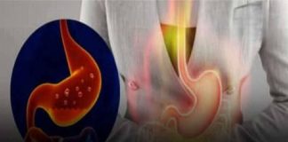 INSTANT RELIEF: THIS SIMPLE, NATURAL DRINK HELPS REDUCE GASTROESOPHAGEAL REFLUX AND HEARTBURN EFFECTIVELY