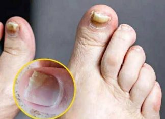 THE SUBTLE FOOT SYMPTOMS YOU SHOULD NEVER IGNORE (TWO DANGEROUS SIGNS EVERY ADULT NEEDS TO KNOW)