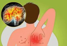 THE COMPLETE GUIDE TO FATTY LIVER: CAUSES, SYMPTOMS, TREATMENT, AND EFFECTIVE HOME REMEDIES