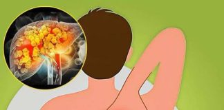 THE COMPLETE GUIDE TO FATTY LIVER: CAUSES, SYMPTOMS, TREATMENT, AND EFFECTIVE HOME REMEDIES