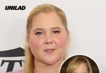 Amy Schumer reveals true reason for weight loss after internet roasting her ‘moon face’ led to diagnosis ‘that can kill you’