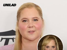Amy Schumer reveals true reason for weight loss after internet roasting her ‘moon face’ led to diagnosis ‘that can kill you’