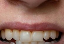 7 HIDDEN REASONS YOUR TEETH ARE TURNING YELLOW — A DENTIST EXPLAINS HOW TO STOP IT