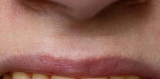 7 HIDDEN REASONS YOUR TEETH ARE TURNING YELLOW — A DENTIST EXPLAINS HOW TO STOP IT