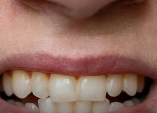 7 HIDDEN REASONS YOUR TEETH ARE TURNING YELLOW — A DENTIST EXPLAINS HOW TO STOP IT
