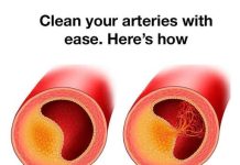 8 ARTERY-CLEANSING FOODS YOU SHOULD BE EATING EVERY DAY FOR A HEALTHY HEART