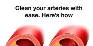 8 ARTERY-CLEANSING FOODS YOU SHOULD BE EATING EVERY DAY FOR A HEALTHY HEART