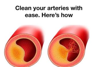8 ARTERY-CLEANSING FOODS YOU SHOULD BE EATING EVERY DAY FOR A HEALTHY HEART