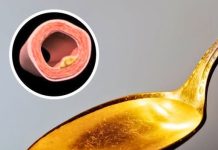 The #1 Food to Unclog Your Arteries Naturally